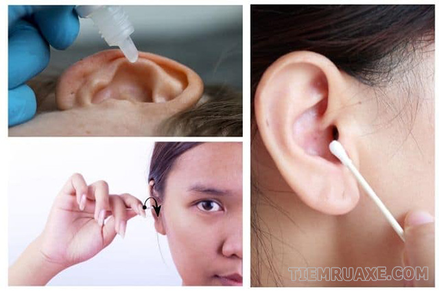 Cách vệ sinh, chăm sóc tai tại nhà an toàn, đúng cách