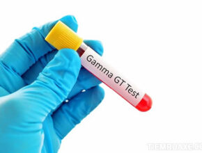 GGT là một trong ba chỉ số thể hiện tình trạng của gan